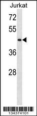 STK33 Antibody