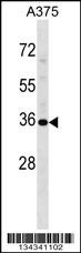 USP12 Antibody