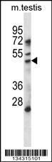 HDAC11 Antibody