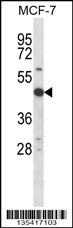 Rps6kb2 Antibody