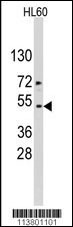ACTC1 Antibody