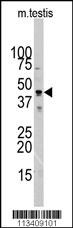 ACTC1 Antibody