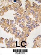 ACTC1 Antibody
