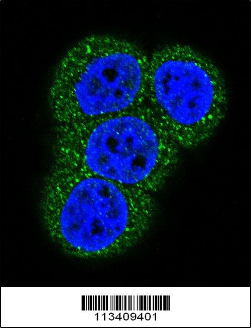 ACTC1 Antibody