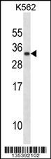 PRL Antibody