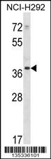 PDLIM1 Antibody