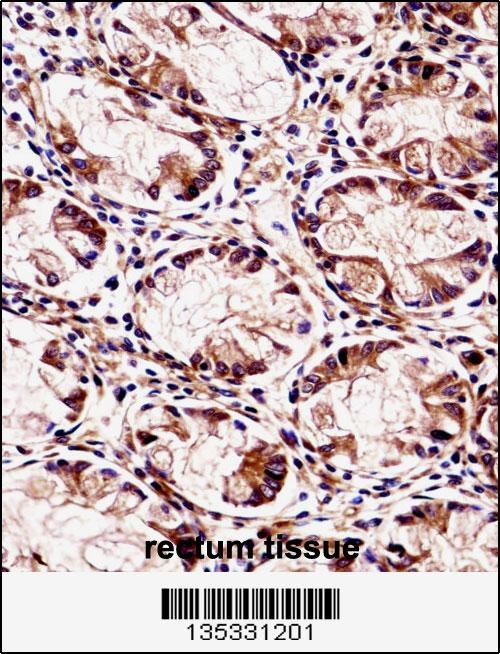 FXYD5 Antibody