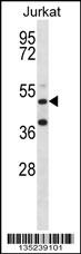 RBM22 Antibody