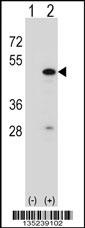 RBM22 Antibody