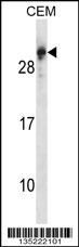 RGS5 Antibody