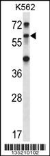 TRIM27 Antibody