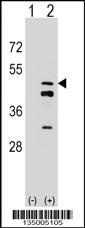 FDPS Antibody