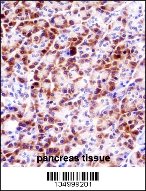 PRSS27 Antibody