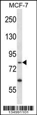 PRKRIR Antibody