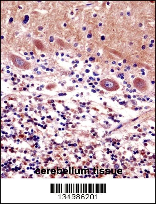 CDR2 Antibody