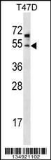 ZDHHC6 Antibody