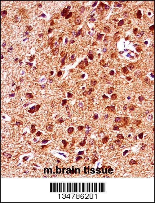 Gsk3b Antibody