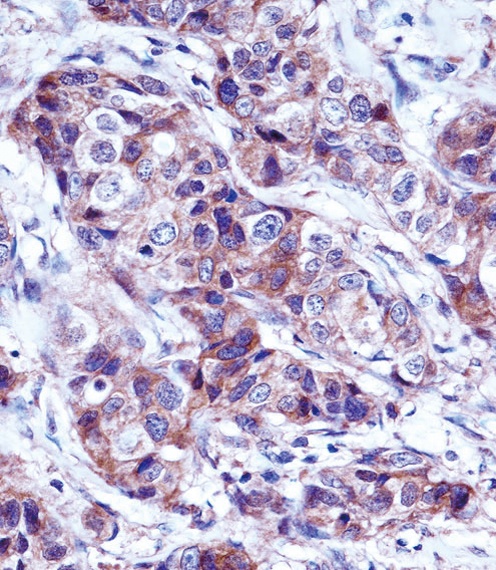 LALBA Antibody