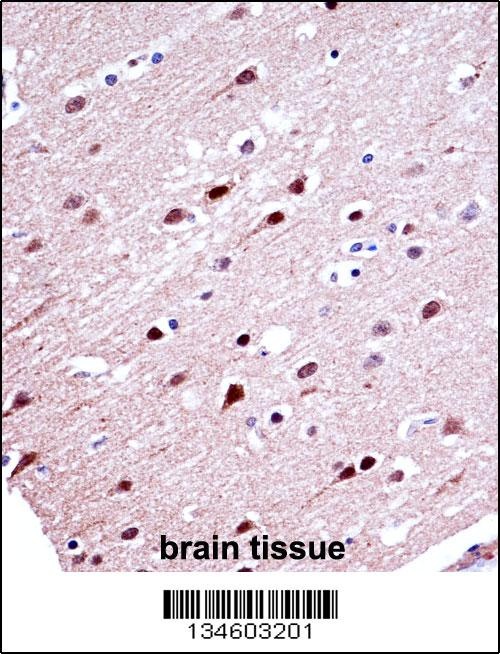 KCND2 Antibody