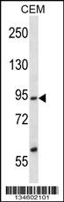 SSRP1 Antibody