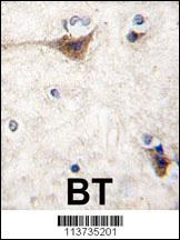 CDH10 Antibody