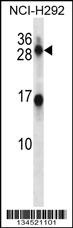 KLK14 Antibody