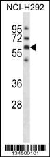 GPC3 Antibody
