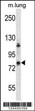 Mouse Adrbk2 Antibody
