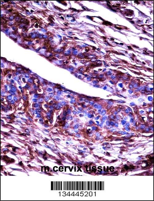 Mouse Adrbk2 Antibody