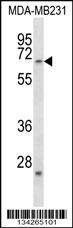 FZD2 Antibody