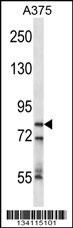 CPSF3 Antibody