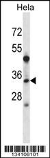 LAT2 Antibody