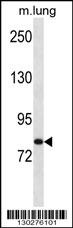 Hunk Antibody