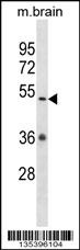 Camkv Antibody