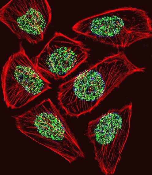 TADA3L Antibody