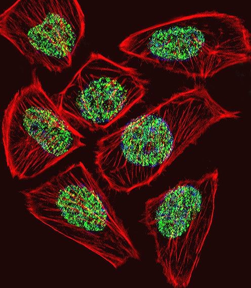 TADA3 Antibody