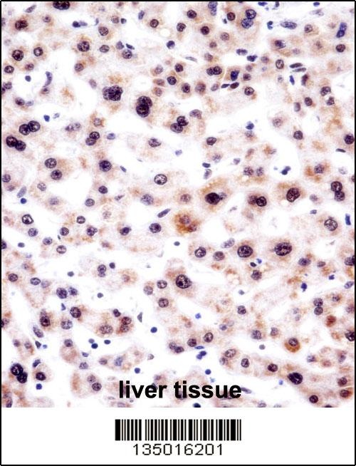 SNRPA Antibody