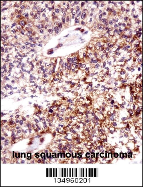 ECT2 Antibody