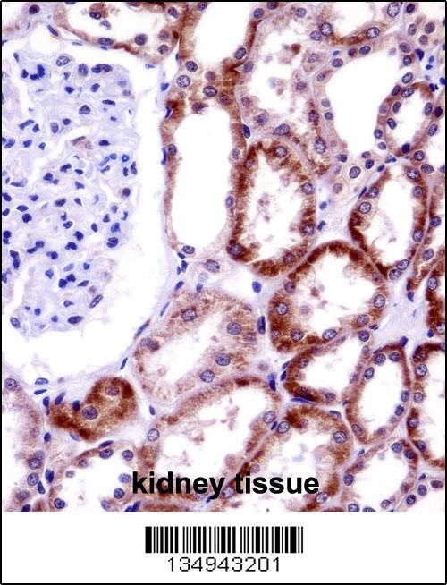 CD70 Antibody