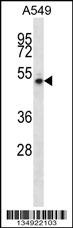 NUDCD1 Antibody