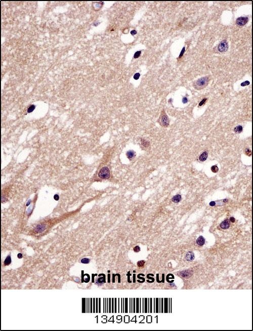 MGARP Antibody