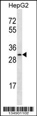 OR4C12 Antibody