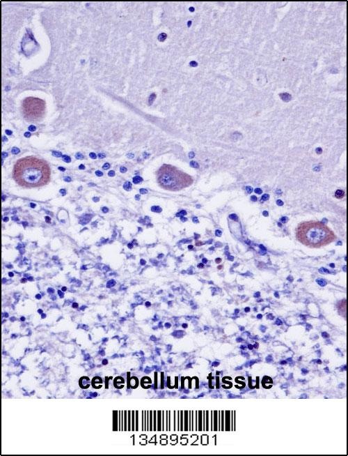 KDELR2 Antibody