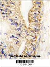 CDH7 Antibody