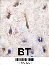 ERAS Antibody