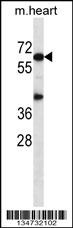 Mouse Akt1 Antibody