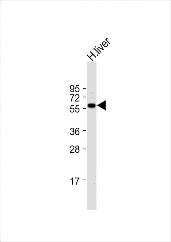 ALDH6A1 Antibody