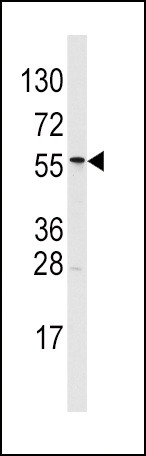 ALDH6A1 Antibody