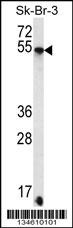SDC3 Antibody