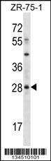 MSX2 Antibody